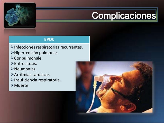 epoc cor pulmonale
